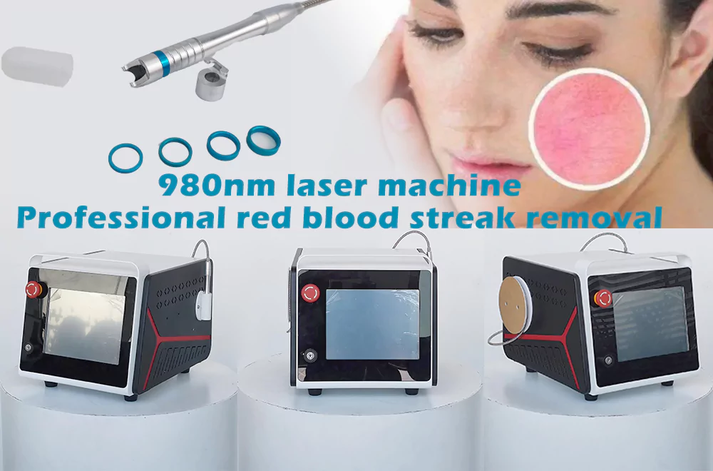 The most cost-effective way to remove red blood streaks